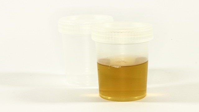 Synthetic Urine 
      Xtreme Forest Ridge (Quail Hollow) Dayton OH